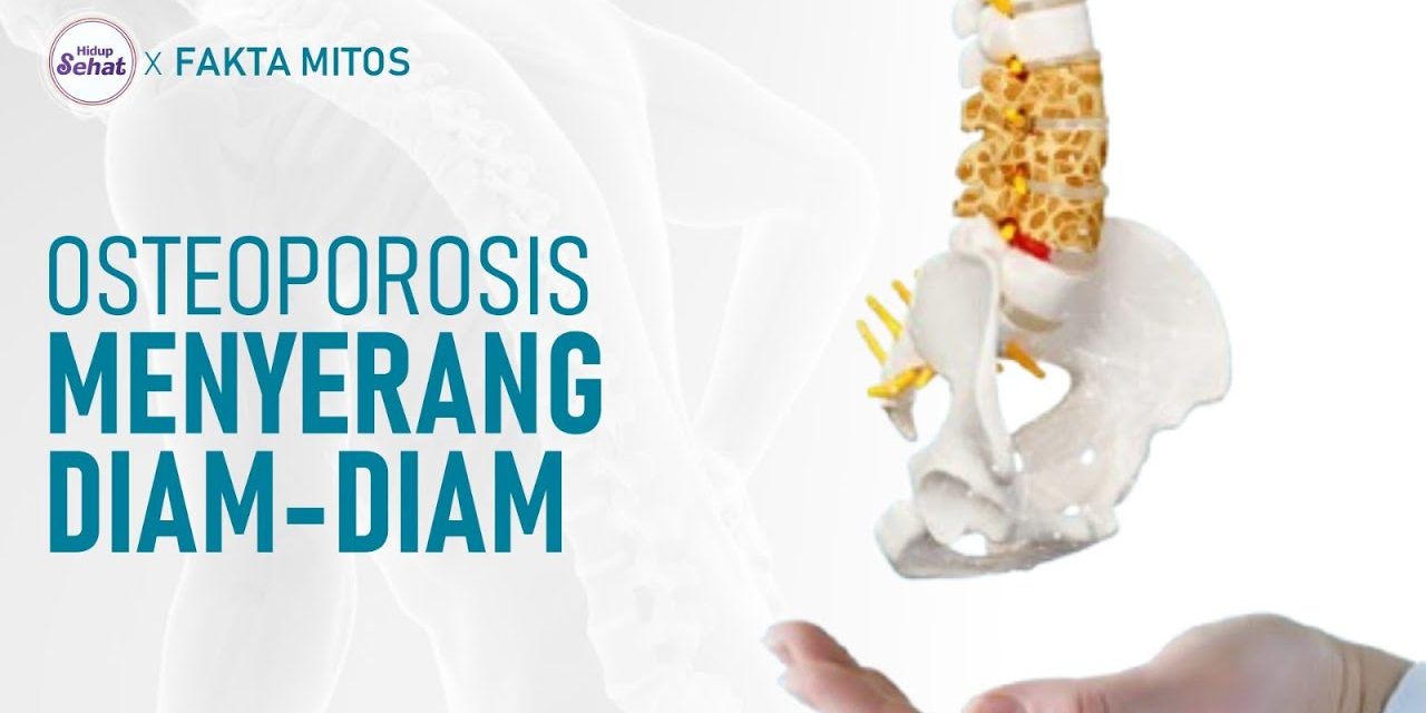 Penyakit Osteoporosis, Turunnya Kepadatan Tulang, Ini Sebabnya!