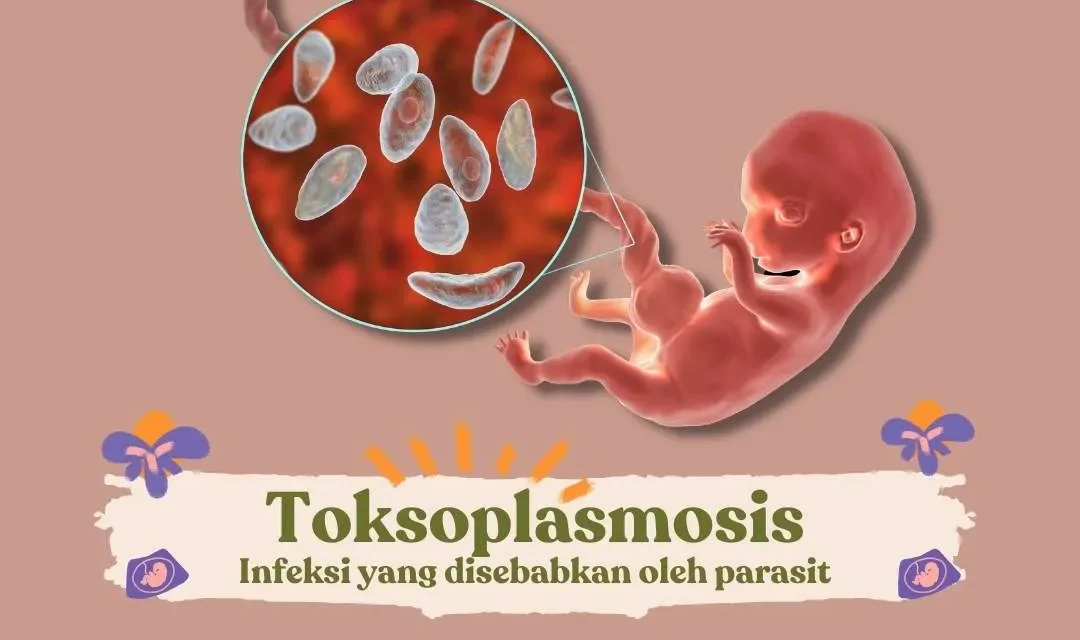 Jangan Abaikan! Inilah Jejak Toksoplasma Yang Krusial Bagi Bumil