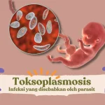 Jangan Abaikan! Inilah Jejak Toksoplasma Yang Krusial Bagi Bumil