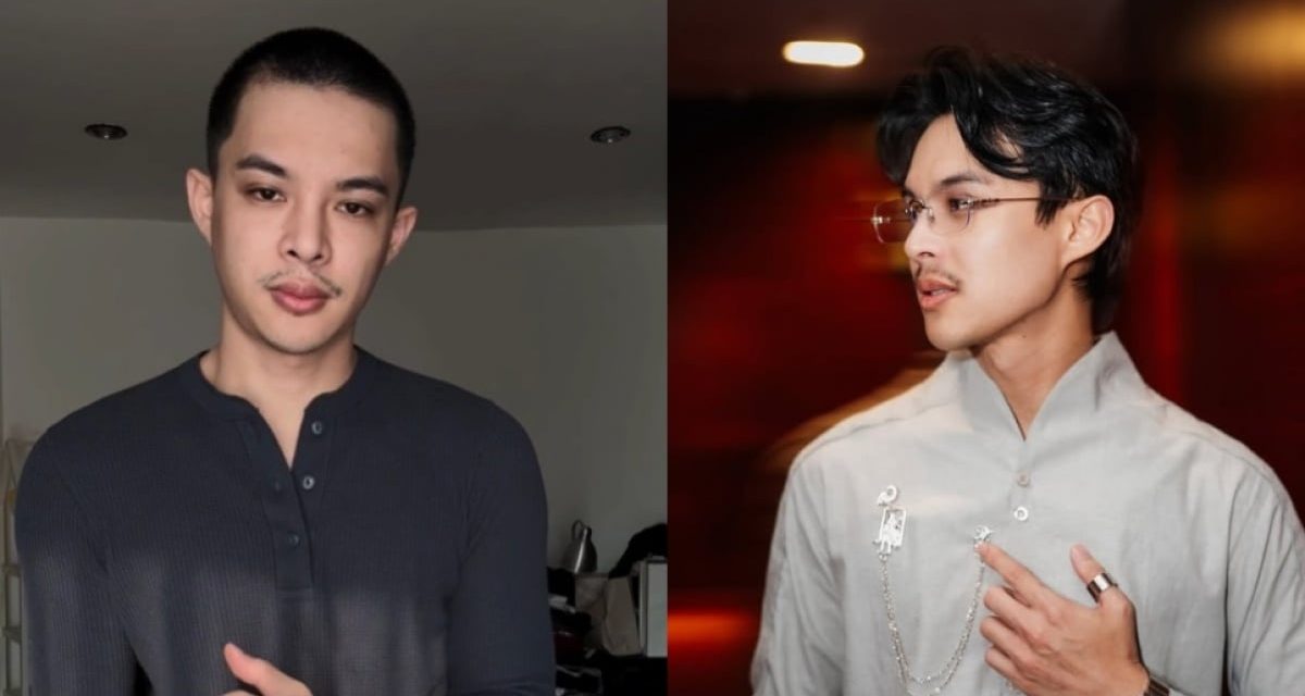 Rey Mbayang: Perjuangannya Menghadapi Autoimun Psoriasis